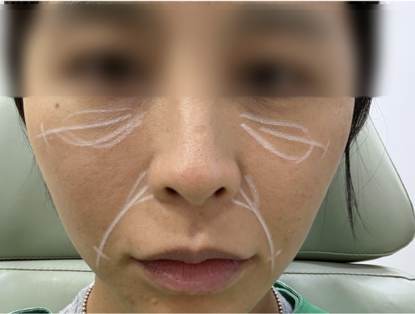 d39c340a81193db0331c5e0d117805ce_1785495484_1461.png